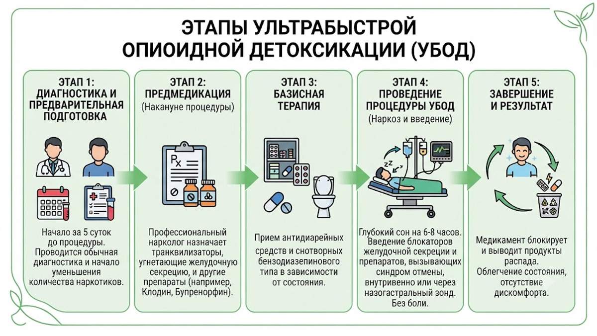 Инфографика: этапы ультрабыстрой опиоидной детоксикации (УБОД), подготовка, медикаментозная терапия и проведение процедуры под наркозом.